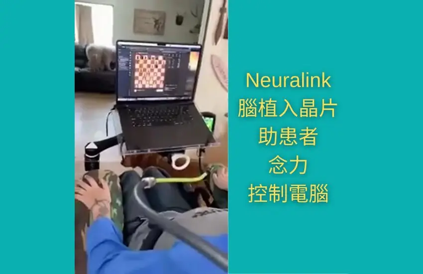 Neuralink腦植入晶片助患者念力控制電腦